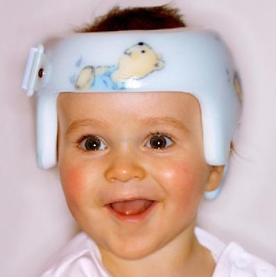 Helmtherapie bei Kleinkindern 