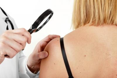 Hautkrebs-Screening,  (c) fotolia.de / fovito