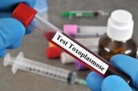 Krankenkassentest: Toxoplasmose-Test