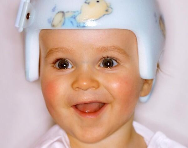 Helmtherapie für Kinder Helmtherapie für Kinder