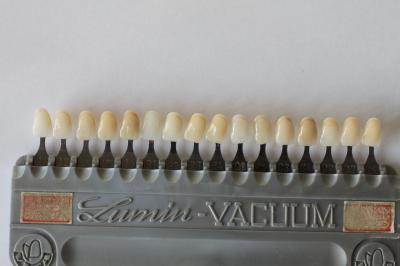 Bei Zahnfüllungen aus Keramik kann die Zahnfarbe optimal angepasst werden.eramik