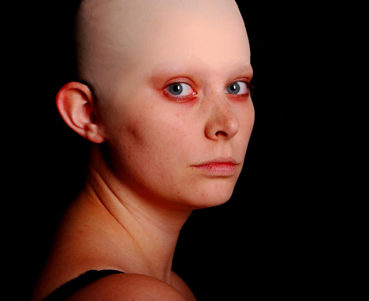 Chemotherapie ohne haarausfall