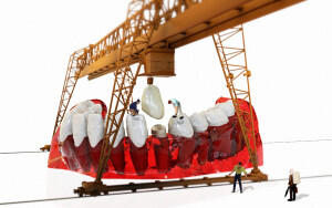 Der Festzuschuss für Zahnersatz steigt,  (c) Wilfried Pohnke / pixabay / CC0