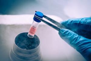 Kryokonservierung von Stammzellen , (c) Jasper Chamber / Getty Images