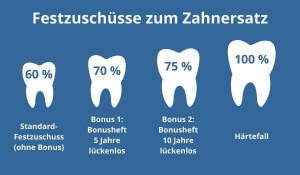 Festzuschuss Zahnersatz