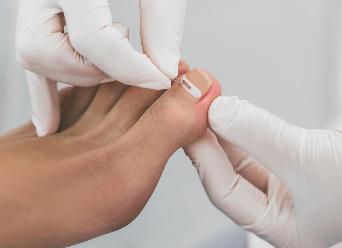 Medizinische Fußpflege / Nagelspange Medizinische Fußpflege / Nagelspange