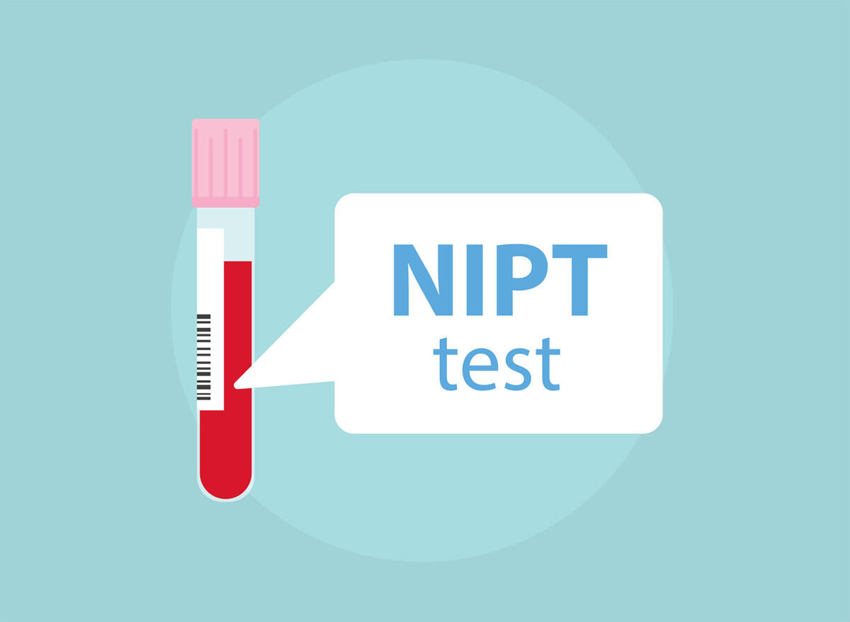 Nicht invasive Pränataltests (NIPT)  