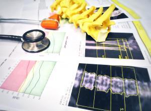Knochendichtemessung bei Krebsdiagnose,  (c) getty Images / Tonpor Kasa