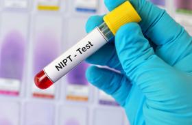 NIPT - genetische Bluttests auf Trisomien 