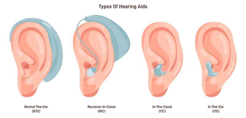 verschiedene Arten von Hörgeräten 