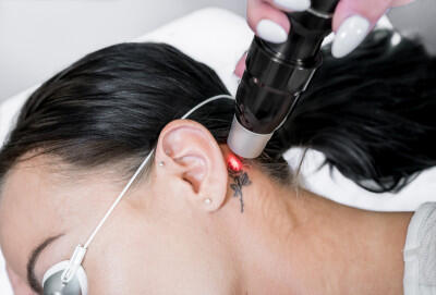 Tattoo entfernen ,  (c) Getty Images / Joyce Grace