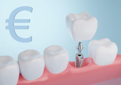 Kostenfalle Implantat bei Zahnersatz 