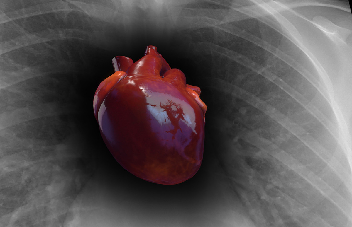 3D Computerdarstellung des menschlichen Herzens 