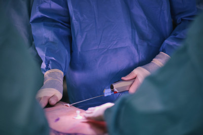 Fettabsaugung (Liposuktion) bei Stoffwechselstörung Lipödem ,  (c) Getty Images / Marc Elias