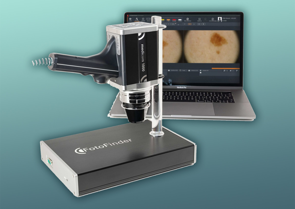 Computergestütztes Hautkrebsscreening Computergestütztes Hautkrebsscreening
