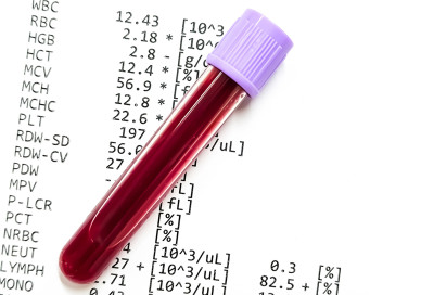 Was kostet ein Blutbild?r 