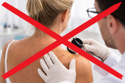 Wird die kostenfreie Hautkrebsvorsorge ab 35 Jahren gestrichen?,  generiert mit GPT 5-2