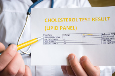Sind Cholesterinwerte zu hoch, drohen Gesundheitsgefahren , (c) Getty Images / Shidlovski Sind Cholesterinwerte zu hoch, drohen Gesundheitsgefahren , (c) Getty Images / Shidlovski