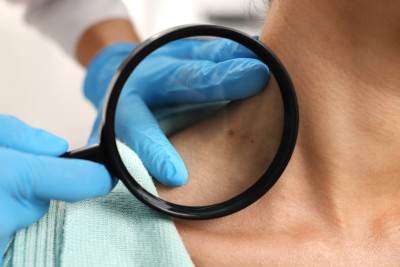 dermatologische Untersuchung