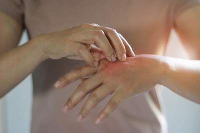 Schuppenflechte, Exzem, Hautekzem, Kratzen, Psoriasis, (c) Getty Images / ipopba Schuppenflechte, Exzem, Hautekzem, Kratzen, Psoriasis, (c) Getty Images / ipopba