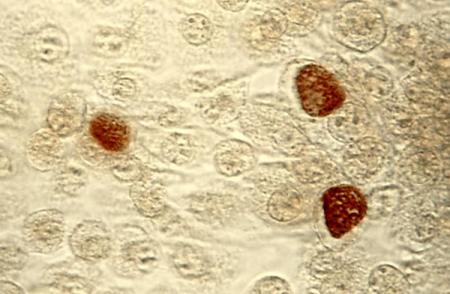 Chlamydien-Erreger in einer elektronenmikroskopischen Aufnahme