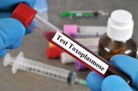 Krankenkassentest: Toxoplasmose-Test