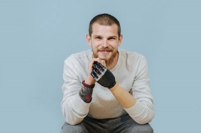 Leben mit einer Handprothese, (c) Getty Images / uznetsovDmitry