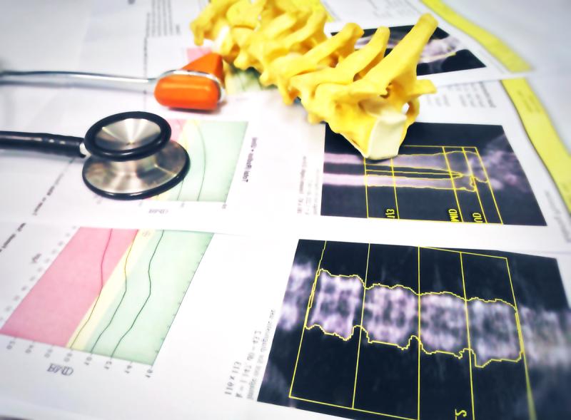 Knochendichtemessung bei Krebsdiagnose Knochendichtemessung bei Krebsdiagnose