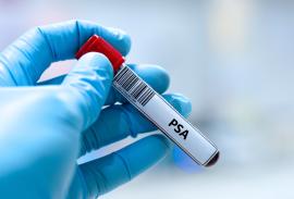 Bestimmung des PSA-Wertes zur Fr&uuml;herkennung von Proststakrebs 