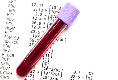 Was kostet ein Blutbild?r 